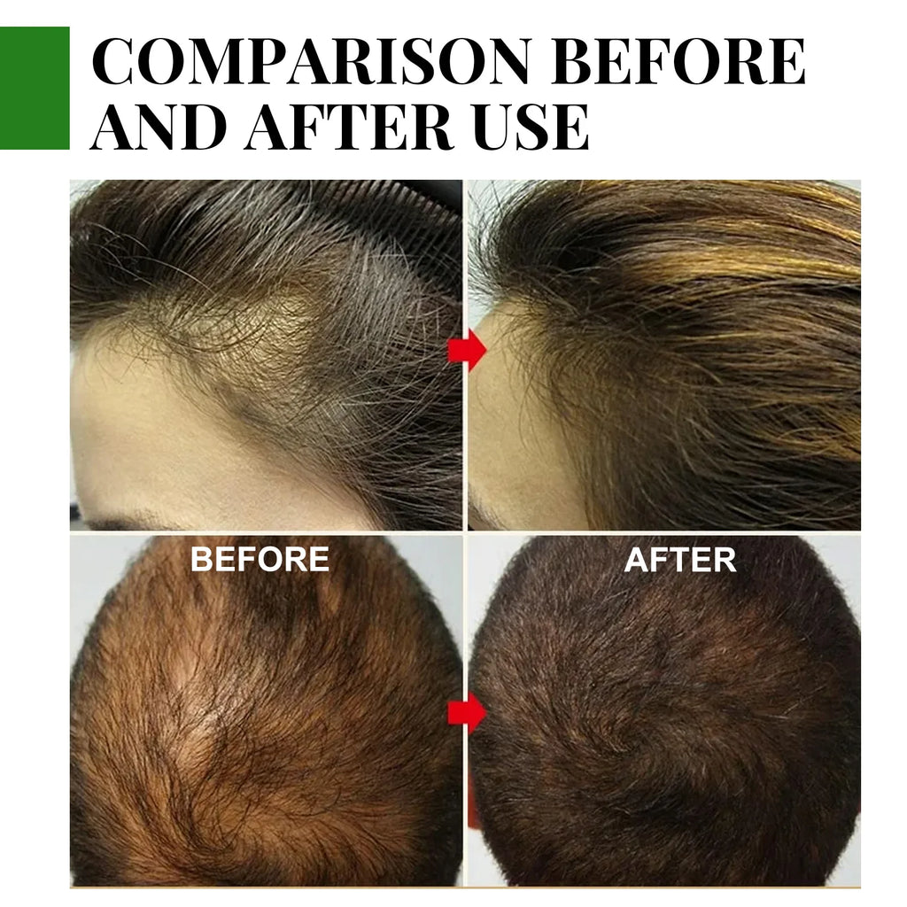RoseGlow™ Hair Growth & Repair Oil 60ml