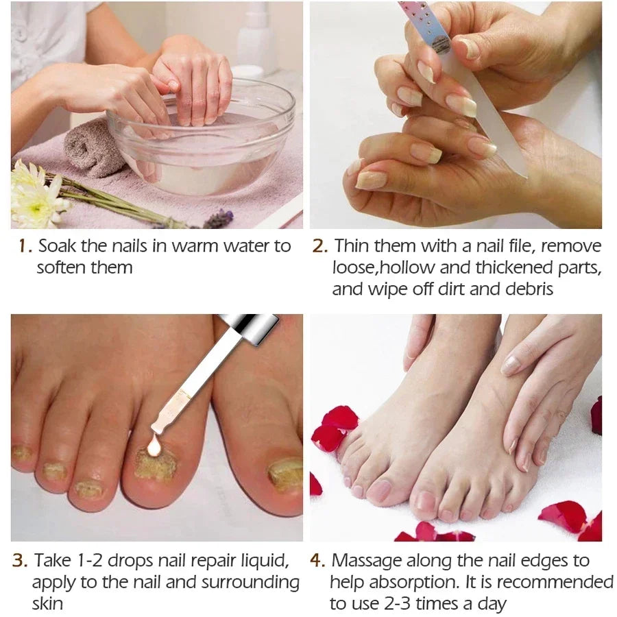NailRenew™ Anti-Fungal Repair Oil 20ml