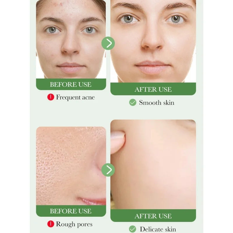 PureBalance™ Centella Cleanser